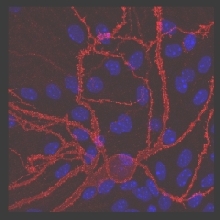 Foto: GABA-A receptor imaging, courtesy by Benjamin M. Bader Rostock